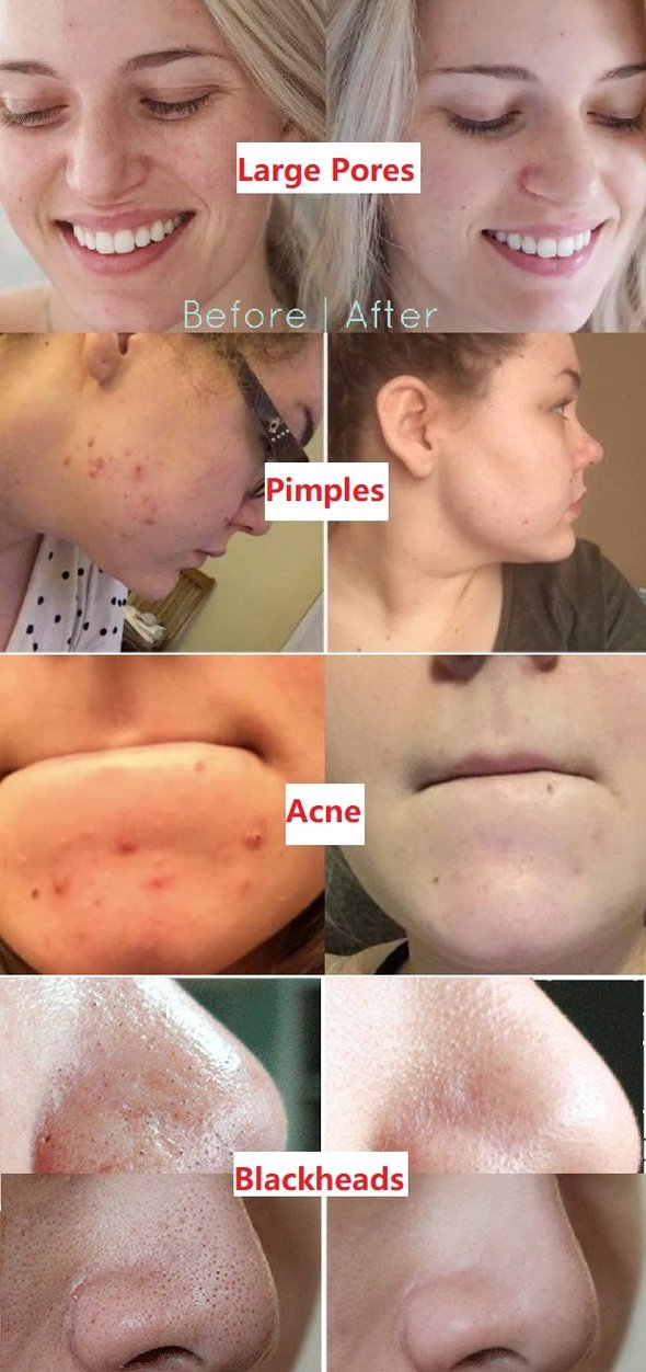 Zunafun™  Green Tea Deep Cleanse Mask Stick