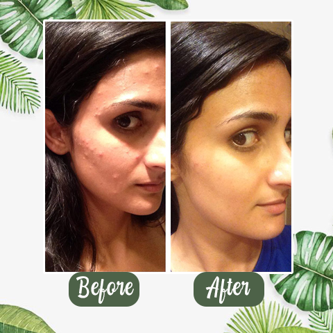 Zunafun™  Green Tea Deep Cleanse Mask Stick