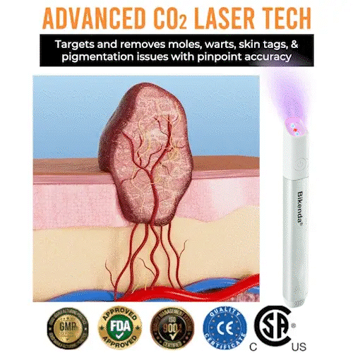 ✨All-in-One CO₂ Laser Eraser Pen | Removes Moles, Warts, Skin Flaws & Pigmentation