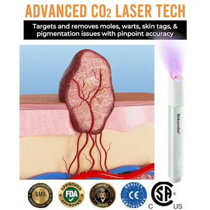 ✨All-in-One CO₂ Laser Eraser Pen | Removes Moles, Warts, Skin Flaws & Pigmentation