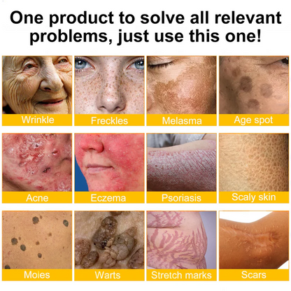 💕FDA Approved:   Bee poison  Pro Comprehensive Cream — 🔥Limited Time 80% OFF🔥