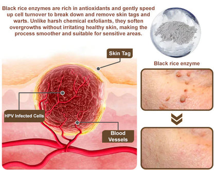 𝑂𝑓𝑓𝑖𝑐𝑖𝑎𝑙 𝑆𝑡𝑜𝑟𝑒 | 𝐷𝑒𝑙ℎ𝑎𝑣𝑒® 17% 𝑆𝑎𝑙𝑖𝑐𝑦𝑙𝑖𝑐 𝐴𝑐𝑖𝑑 𝐵𝑙𝑎𝑐𝑘 𝑅𝑖𝑐𝑒 𝑆𝑘𝑖𝑛 𝑅𝑒𝑝𝑎𝑖𝑟 𝐸𝑠𝑠𝑒𝑛𝑐𝑒 𝐶𝑟𝑒𝑎𝑚 👩‍⚕️ FDA-Certified (For removing warts and skin growths, eliminating skin hyperplasia and keratin buildup, treating skin cancer, age spots, and hyperpigmentation)