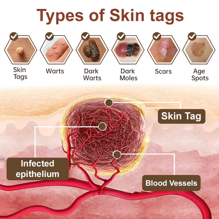 𝑂𝑓𝑓𝑖𝑐𝑖𝑎𝑙 𝑆𝑡𝑜𝑟𝑒 | 𝐷𝑒𝑙ℎ𝑎𝑣𝑒® 17% 𝑆𝑎𝑙𝑖𝑐𝑦𝑙𝑖𝑐 𝐴𝑐𝑖𝑑 𝐵𝑙𝑎𝑐𝑘 𝑅𝑖𝑐𝑒 𝑆𝑘𝑖𝑛 𝑅𝑒𝑝𝑎𝑖𝑟 𝐸𝑠𝑠𝑒𝑛𝑐𝑒 𝐶𝑟𝑒𝑎𝑚 👩‍⚕️ FDA-Certified (For removing warts and skin growths, eliminating skin hyperplasia and keratin buildup, treating skin cancer, age spots, and hyperpigmentation)