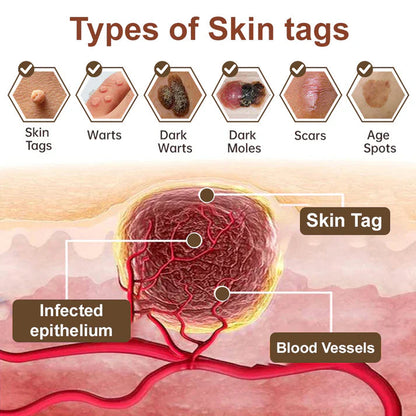 𝑂𝑓𝑓𝑖𝑐𝑖𝑎𝑙 𝑆𝑡𝑜𝑟𝑒 | 𝐷𝑒𝑙ℎ𝑎𝑣𝑒® 17% 𝑆𝑎𝑙𝑖𝑐𝑦𝑙𝑖𝑐 𝐴𝑐𝑖𝑑 𝐵𝑙𝑎𝑐𝑘 𝑅𝑖𝑐𝑒 𝑆𝑘𝑖𝑛 𝑅𝑒𝑝𝑎𝑖𝑟 𝐸𝑠𝑠𝑒𝑛𝑐𝑒 𝐶𝑟𝑒𝑎𝑚 👩‍⚕️ FDA-Certified (For removing warts and skin growths, eliminating skin hyperplasia and keratin buildup, treating skin cancer, age spots, and hyperpigmentation)