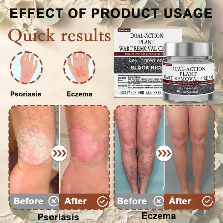 𝑂𝑓𝑓𝑖𝑐𝑖𝑎𝑙 𝑆𝑡𝑜𝑟𝑒 | 𝐷𝑒𝑙ℎ𝑎𝑣𝑒® 17% 𝑆𝑎𝑙𝑖𝑐𝑦𝑙𝑖𝑐 𝐴𝑐𝑖𝑑 𝐵𝑙𝑎𝑐𝑘 𝑅𝑖𝑐𝑒 𝑆𝑘𝑖𝑛 𝑅𝑒𝑝𝑎𝑖𝑟 𝐸𝑠𝑠𝑒𝑛𝑐𝑒 𝐶𝑟𝑒𝑎𝑚 👩‍⚕️ FDA-Certified (For removing warts and skin growths, eliminating skin hyperplasia and keratin buildup, treating skin cancer, age spots, and hyperpigmentation)