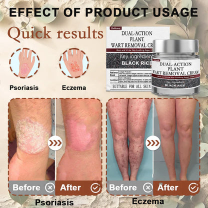 𝑂𝑓𝑓𝑖𝑐𝑖𝑎𝑙 𝑆𝑡𝑜𝑟𝑒 | 𝐷𝑒𝑙ℎ𝑎𝑣𝑒® 17% 𝑆𝑎𝑙𝑖𝑐𝑦𝑙𝑖𝑐 𝐴𝑐𝑖𝑑 𝐵𝑙𝑎𝑐𝑘 𝑅𝑖𝑐𝑒 𝑆𝑘𝑖𝑛 𝑅𝑒𝑝𝑎𝑖𝑟 𝐸𝑠𝑠𝑒𝑛𝑐𝑒 𝐶𝑟𝑒𝑎𝑚 👩‍⚕️ FDA-Certified (For removing warts and skin growths, eliminating skin hyperplasia and keratin buildup, treating skin cancer, age spots, and hyperpigmentation)