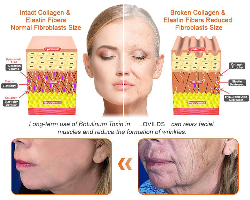 💕FDA Approved:   Bee poison  Pro Comprehensive Cream — 🔥Limited Time 80% OFF🔥