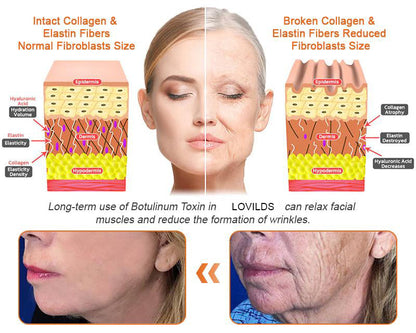 💕FDA Approved:   Bee poison  Pro Comprehensive Cream — 🔥Limited Time 80% OFF🔥