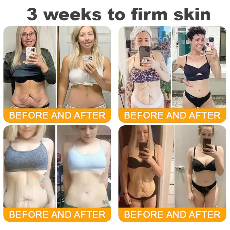 Made and Shipped from USA ✨ 𝐷𝑒𝑙ℎ𝑎𝑣𝑒® 𝐵𝑒𝑒 𝑉𝑒𝑛𝑜𝑚 & 𝑅𝑒𝑡𝑖𝑛𝑜𝑙 𝐶𝑜𝑚𝑝𝑙𝑒𝑥 𝑆𝑘𝑖𝑛 𝑅𝑒𝑠𝑡𝑜𝑟𝑎𝑡𝑖𝑜𝑛 𝐶𝑟𝑒𝑎𝑚🔥 LAST DAY 80% OFF 💎