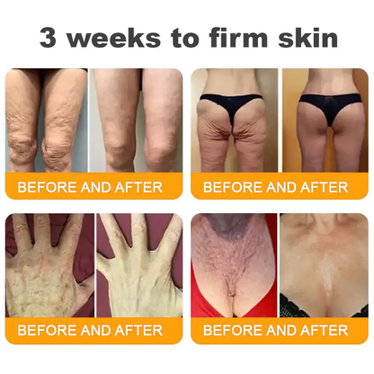 Made and Shipped from USA ✨ 𝐷𝑒𝑙ℎ𝑎𝑣𝑒® 𝐵𝑒𝑒 𝑉𝑒𝑛𝑜𝑚 & 𝑅𝑒𝑡𝑖𝑛𝑜𝑙 𝐶𝑜𝑚𝑝𝑙𝑒𝑥 𝑆𝑘𝑖𝑛 𝑅𝑒𝑠𝑡𝑜𝑟𝑎𝑡𝑖𝑜𝑛 𝐶𝑟𝑒𝑎𝑚🔥 LAST DAY 80% OFF 💎