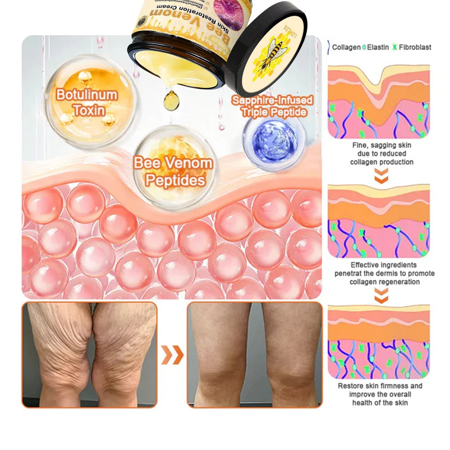 💕FDA Approved:   Bee poison  Pro Comprehensive Cream — 🔥Limited Time 80% OFF🔥