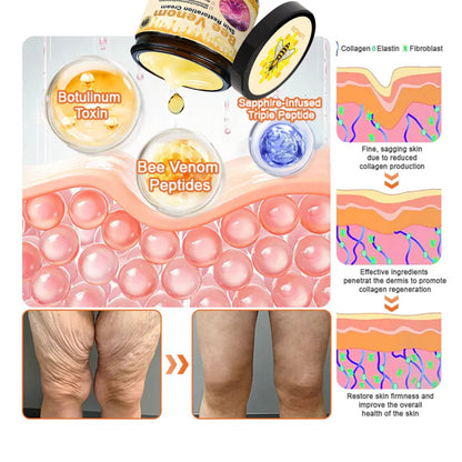 💕FDA Approved:   Bee poison  Pro Comprehensive Cream — 🔥Limited Time 80% OFF🔥