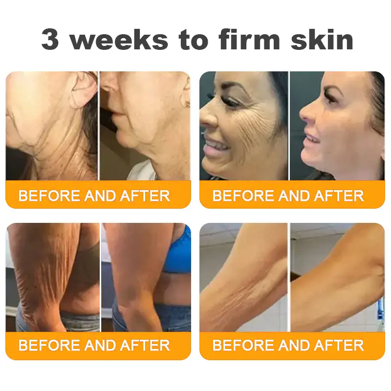 Made and Shipped from USA ✨ 𝐷𝑒𝑙ℎ𝑎𝑣𝑒® 𝐵𝑒𝑒 𝑉𝑒𝑛𝑜𝑚 & 𝑅𝑒𝑡𝑖𝑛𝑜𝑙 𝐶𝑜𝑚𝑝𝑙𝑒𝑥 𝑆𝑘𝑖𝑛 𝑅𝑒𝑠𝑡𝑜𝑟𝑎𝑡𝑖𝑜𝑛 𝐶𝑟𝑒𝑎𝑚🔥 LAST DAY 80% OFF 💎