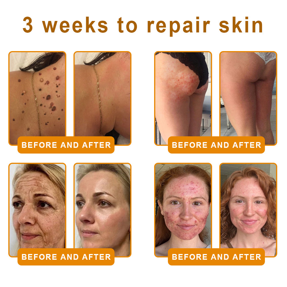 Made and Shipped from USA ✨ 𝐷𝑒𝑙ℎ𝑎𝑣𝑒® 𝐵𝑒𝑒 𝑉𝑒𝑛𝑜𝑚 & 𝑅𝑒𝑡𝑖𝑛𝑜𝑙 𝐶𝑜𝑚𝑝𝑙𝑒𝑥 𝑆𝑘𝑖𝑛 𝑅𝑒𝑠𝑡𝑜𝑟𝑎𝑡𝑖𝑜𝑛 𝐶𝑟𝑒𝑎𝑚🔥 LAST DAY 80% OFF 💎