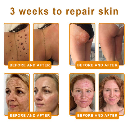 Made and Shipped from USA ✨ 𝐷𝑒𝑙ℎ𝑎𝑣𝑒® 𝐵𝑒𝑒 𝑉𝑒𝑛𝑜𝑚 & 𝑅𝑒𝑡𝑖𝑛𝑜𝑙 𝐶𝑜𝑚𝑝𝑙𝑒𝑥 𝑆𝑘𝑖𝑛 𝑅𝑒𝑠𝑡𝑜𝑟𝑎𝑡𝑖𝑜𝑛 𝐶𝑟𝑒𝑎𝑚🔥 LAST DAY 80% OFF 💎