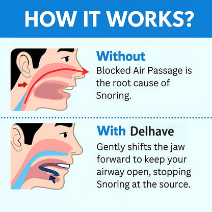 Delhave® The Quiet Anti-Snoring Mouthpiece Universal Size
