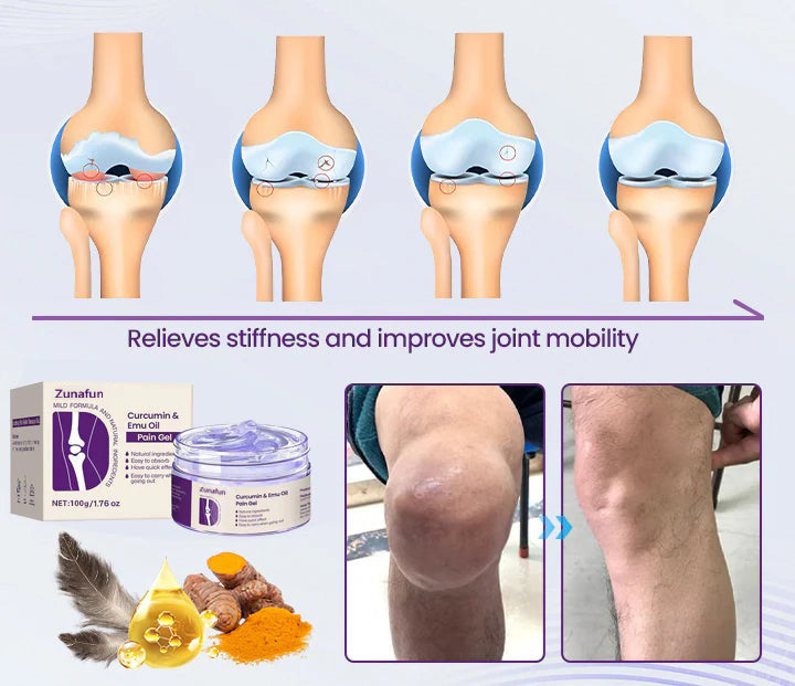 Zunafun™ Curcumin & Emu Oil Pain Gel – 🏥Backed by US Osteopathic Experts