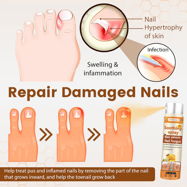 VanaSculpt® Bee Venom Nail Fungus Spray