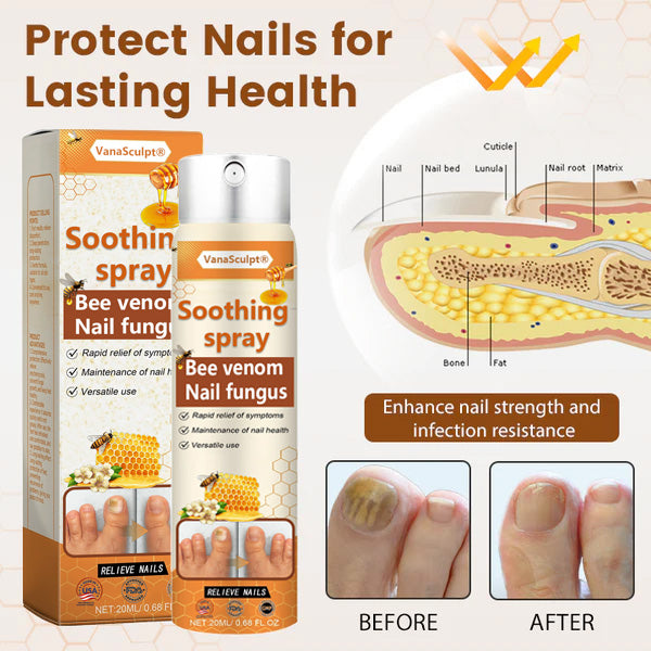VanaSculpt® Bee Venom Nail Fungus Spray
