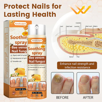 VanaSculpt® Bee Venom Nail Fungus Spray