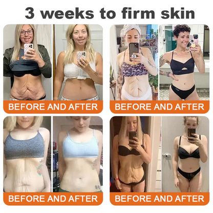 💕FDA Approved:   Bee poison  Pro Comprehensive Cream — 🔥Limited Time 80% OFF🔥