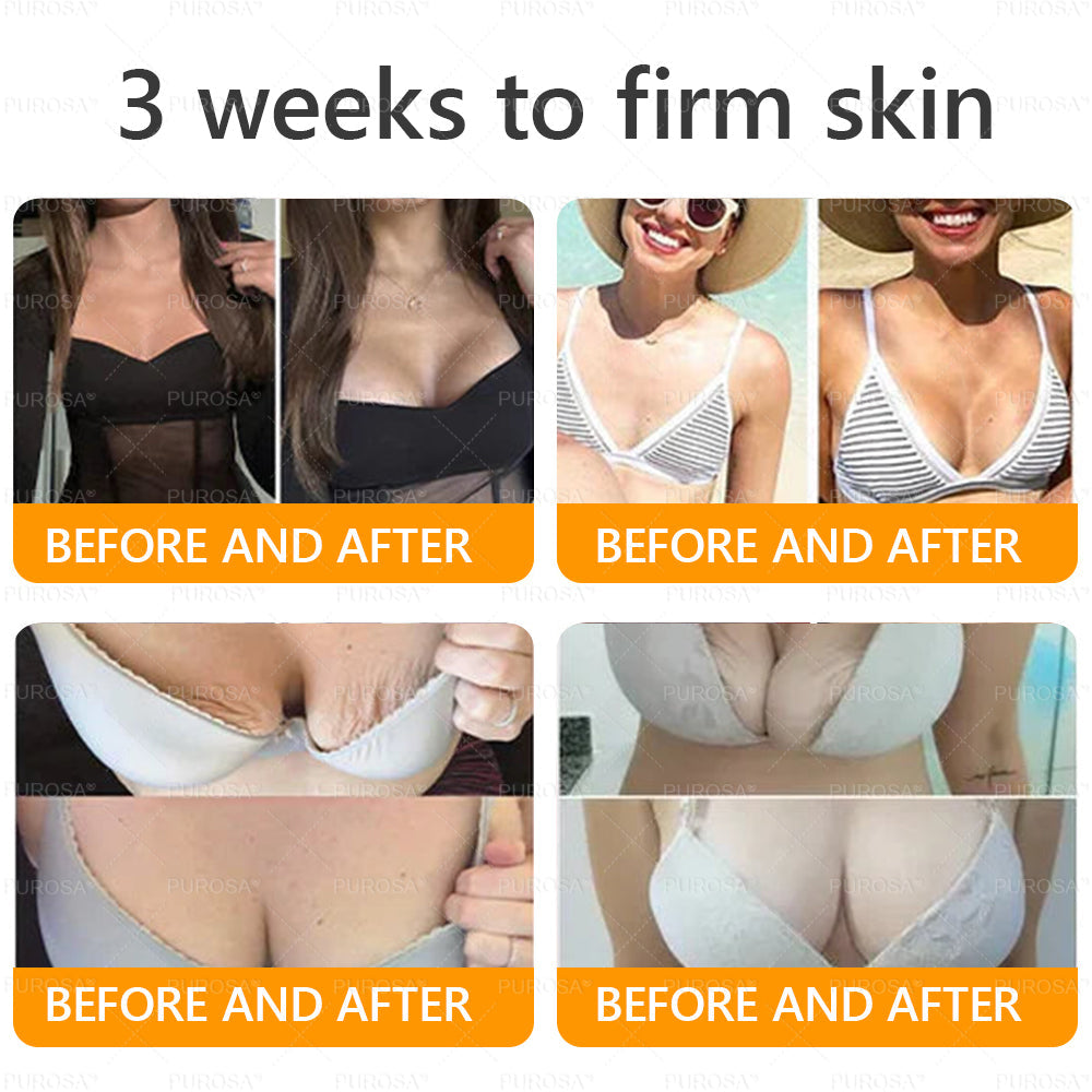 Made and Shipped from USA ✨ 𝐷𝑒𝑙ℎ𝑎𝑣𝑒® 𝐵𝑒𝑒 𝑉𝑒𝑛𝑜𝑚 & 𝑅𝑒𝑡𝑖𝑛𝑜𝑙 𝐶𝑜𝑚𝑝𝑙𝑒𝑥 𝑆𝑘𝑖𝑛 𝑅𝑒𝑠𝑡𝑜𝑟𝑎𝑡𝑖𝑜𝑛 𝐶𝑟𝑒𝑎𝑚🔥 LAST DAY 80% OFF 💎