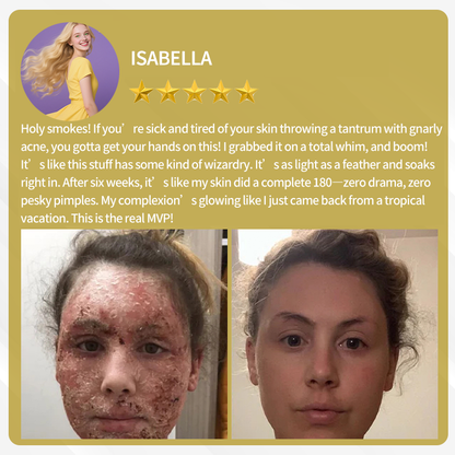 🔥FDA Approved:  Bee Venom Skin Restoration Cream — 🔥Limited Time 80% OFF🔥