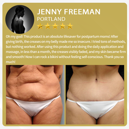 🔥FDA Approved:  Bee Venom Skin Restoration Cream — 🔥Limited Time 80% OFF🔥