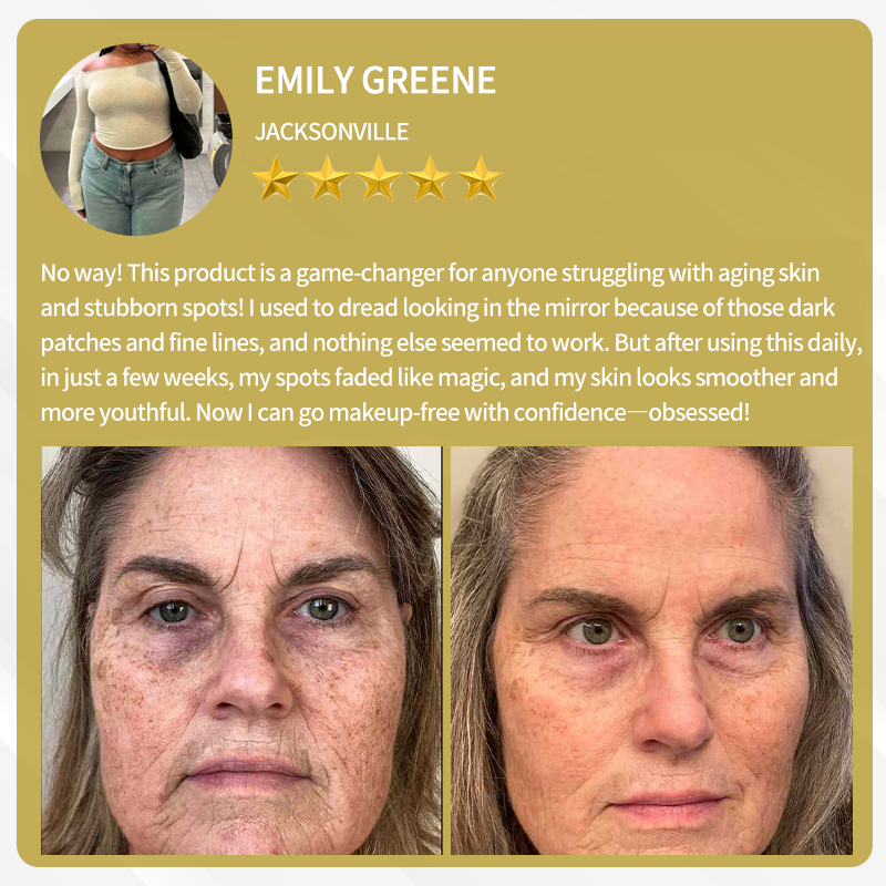 🔥FDA Approved:  Bee Venom Skin Restoration Cream — 🔥Limited Time 80% OFF🔥