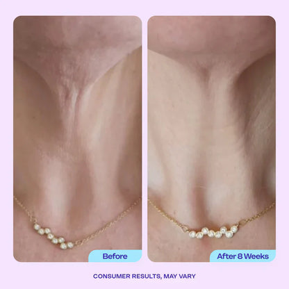 GOPUCE Miracle Neck Cream: Erase "Turkey Neck" & "Tech Neck" Lines Visible Lift & Smoothness in 4 Weeks